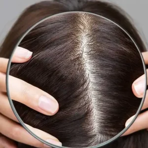 اسکالپ سر چیست؟ معرفی کامل مزایا و روش‌های انجام آن